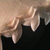 Tigerhajens savtakkede tænder - En mand har filmet sit lår, umiddelbart efter han bidt af en tigerhaj