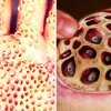 Trypophobia Challenge |Watch This Video Untill The End - Hvad er trypofobi? 