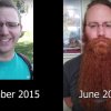 En bros bombastiske beard-transformation